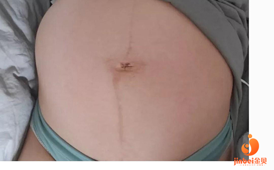 太原双胞胎三代试管婴儿机构-我在4月11日排了卵，我已经准备怀孕一个月了(图2)