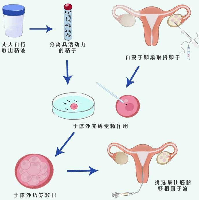广州有供卵试管医院吗?：试管婴儿和体外受精的区别是什么？
