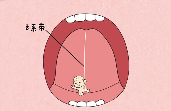 苏州助孕宝宝联系方式：宝宝的舌系带该不该剪，家长们应该考虑到这个因素。(图1)