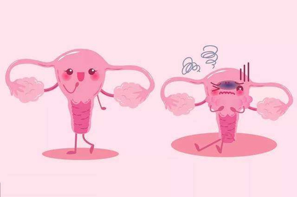 南通供卵生子：子宫内膜结核可以在试管婴儿前治愈，通过对子宫内膜结核的治疗。